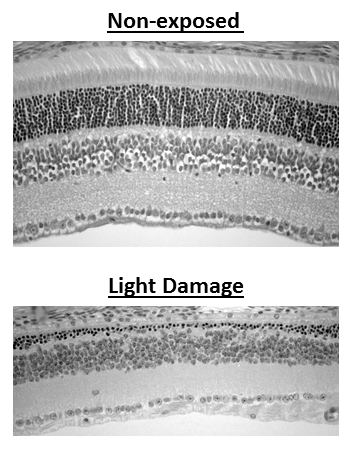 light damage histology